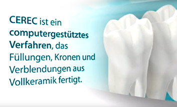 Informationsvideo zum Einsatz von Füllungen, Kronen & Verblendungen