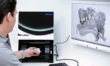 CEREC zur Zahnrestauration